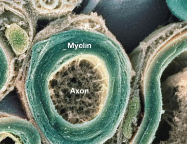 Ảnh hiển vi mặt cắt sợi thần kinh có bao myelin cách điện quanh sợi trục