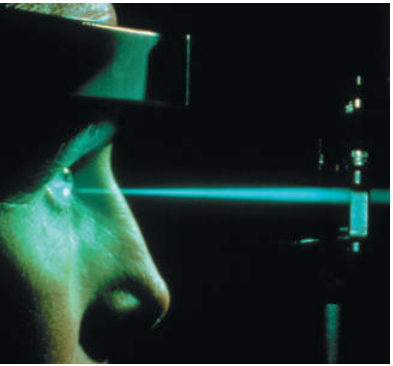 Hình 33.2: Các phẫu thuật viên nhãn khoa sử dụng chùm laser để hàn gắn võng mạc bị bong và làm đông các mạch máu trong bệnh võng mạc. Các xung ánh sáng màu lục-lam từ laser argon là lý tưởng cho mục đích này vì chúng truyền qua phần trong suốt của mắt mà không gây tổn hại, nhưng lại được hấp thụ bởi các sắc tố đỏ trên võng mạc.