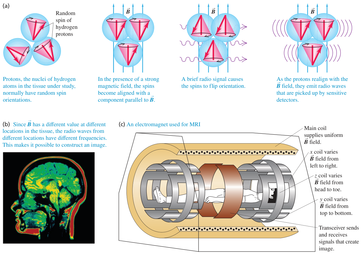 Hình 43.1: Chụp cộng hưởng từ (MRI). Nguyên lý định vị không gian và ghi nhận tín hiệu sóng vô tuyến phát ra từ sự hồi phục spin của các proton hydro trong các mô sinh học.
