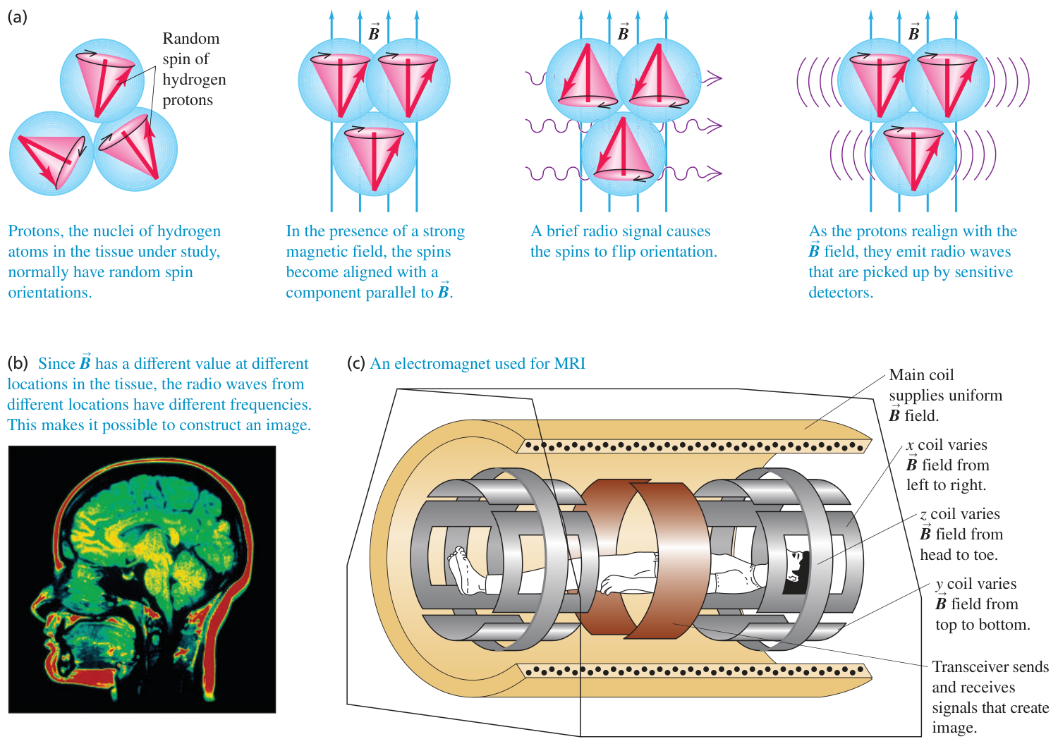 Hình 43.1: Sơ đồ nguyên lý chụp cộng hưởng từ hạt nhân (MRI).